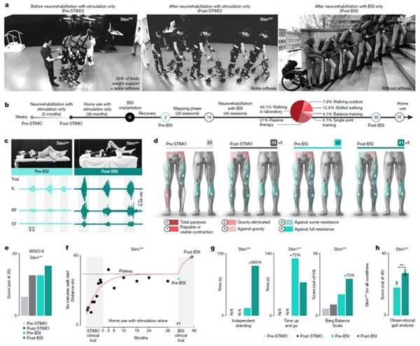突破!脑脊接口让瘫痪者恢复独立行走