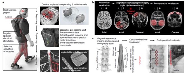 突破!脑脊接口让瘫痪者恢复独立行走